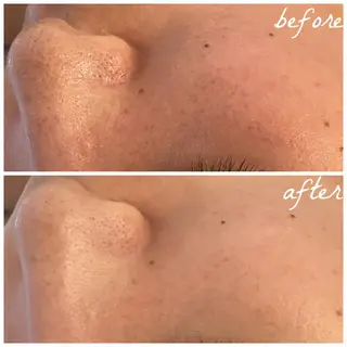 メンズ メナード岐阜市茜部 杉浦のエステ・リラクイメージ