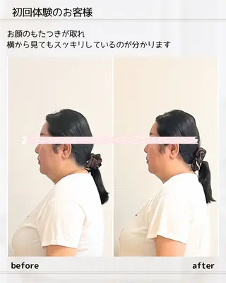 小顔矯正& 慢性肩こり腰痛改善店のエステ・リラクイメージ