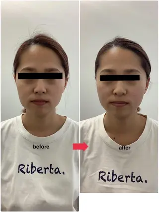 メディカルサロンドオフ所属・ハリサロンドオフ 美容鍼灸×小顔整体のエステ・リラクイメージ