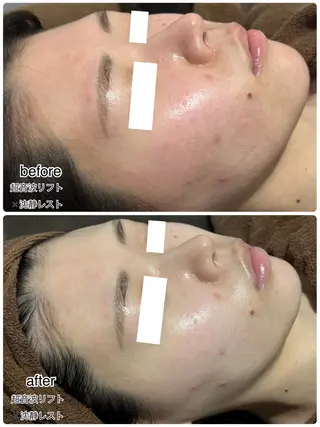 ENCHANT 脱毛.小顔.毛穴のエステ・リラクイメージ