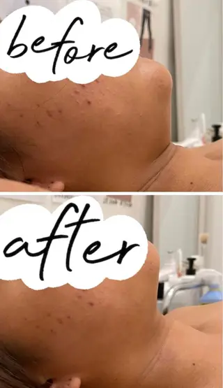 VOIR東静岡店所属・竹内 彩香のエステ・リラクイメージ