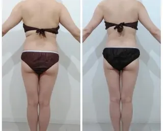 秒速小顔  恵比寿店所属・秒速小顔 恵比寿店 店長 さきのエステ・リラクイメージ