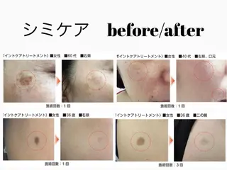 リオッサ  オブ ラグーン神戸店のエステ・リラクイメージ