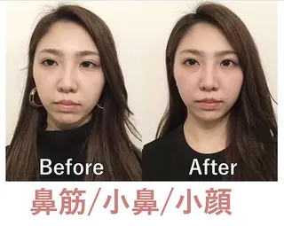 美鼻&小顔専門店 ラプリ　毛井のエステ・リラクイメージ