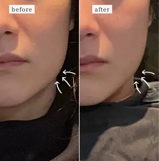 小顔矯正/ヘッドスパ /arieのエステ・リラクイメージ