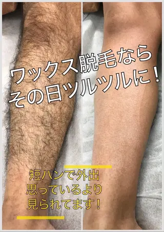 メンズ メンズ脱毛 ビーグラッド神戸三宮のエステ・リラクイメージ