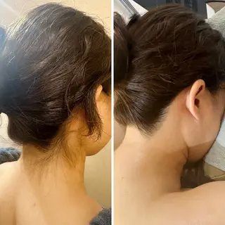 うなじ脱毛/美肌脱毛 LABELのエステ・リラクイメージ