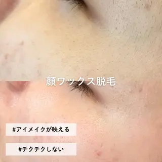 EST BEAUTY所属・顔ワックス脱毛/ ハーブピーリングのエステ・リラクイメージ