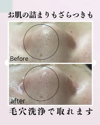 肌質改善サロン facialmoonのエステ・リラクイメージ