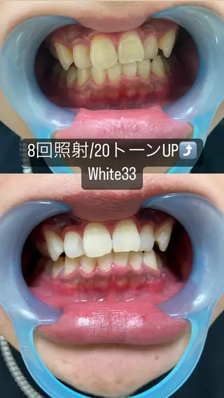 アイブロウ セルフホワイトニング White33大名のその他イメージ