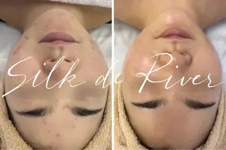 SILKdeCOCO yuriaのエステ・リラクイメージ