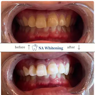 NAホワイトニング溝の口店所属・NAホワイトニング 溝の口店のエステ・リラクイメージ