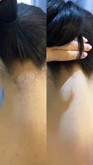 うなじ脱毛/美肌脱毛 LABELのエステ・リラクイメージ