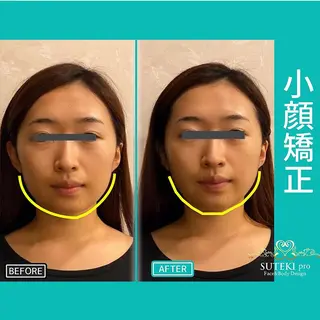 姿勢・骨盤/小顔矯正 痩身ダイエット 横田のエステ・リラクイメージ