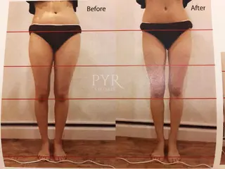 カラー マツエク・マツパ 美容鍼専門 ハリエンジュのエステ・リラクイメージ