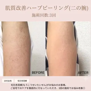 肌質改善専門サロン Bellmi/心斎橋のエステ・リラクイメージ