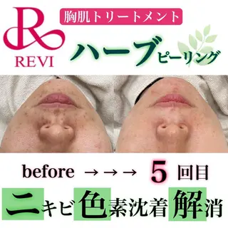 laluna saki...のその他イメージ