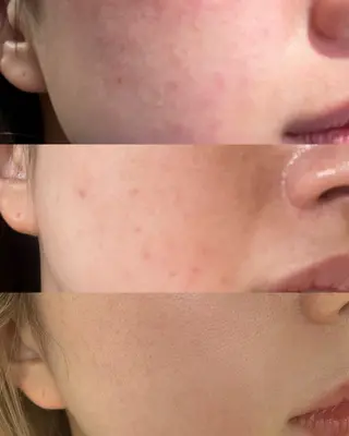 ハーブピーリング専門店lume(ルーム)所属・瀧野 史園のエステ・リラクイメージ