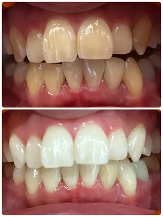 ベルーテ エッセンスのエステ・リラクイメージ