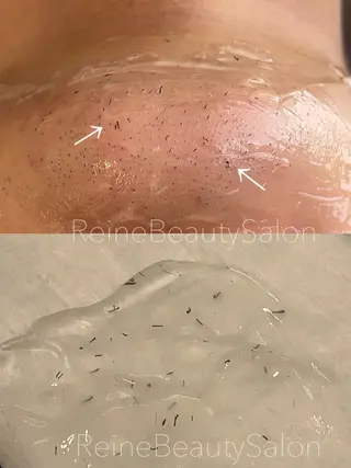 Reine BeautySalon所属・毛穴/シミ肝斑/脱毛 横山梨里のエステ・リラクイメージ