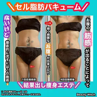 痩身/脱毛/ネイル HARUKAのエステ・リラクイメージ