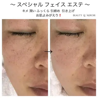 ビューティー ミロワールのエステ・リラクイメージ