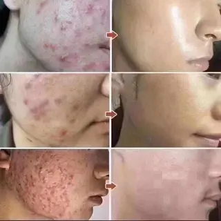 愛維美水光美肌専門店所属・愛維美水光美肌専門店 メンズレディースokのエステ・リラクイメージ