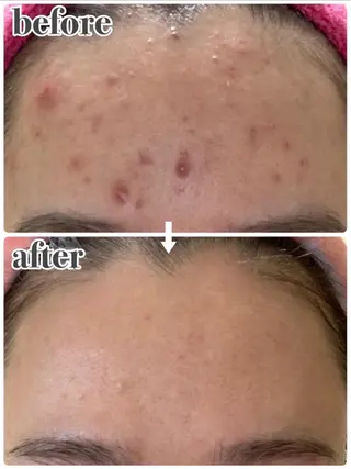 RinRin 鈴鹿店のエステ・リラクイメージ