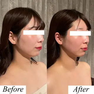 グレースフィオーレ上野御徒町店所属・頭蓋骨小顔矯正 上野御徒町店＊かんなのエステ・リラクイメージ