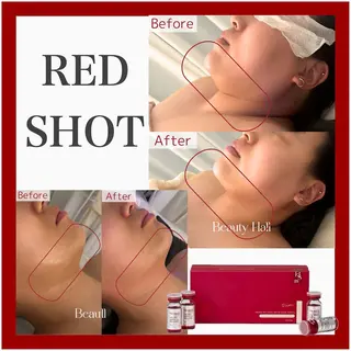 フェイシャル/脱毛 ジョアアンジェ小夷のエステ・リラクイメージ