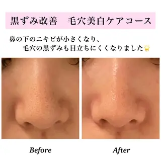 Bellesthe （ベルエステ）のエステ・リラクイメージ