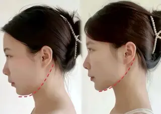 マツエク・マツパ aliaハイフ&水光ジェットサロン所属・aliaハーブ水光店 エステティシャン募集のエステ・リラクイメージ