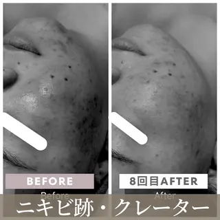 小顔矯正専門店 【RED】池田のエステ・リラクイメージ