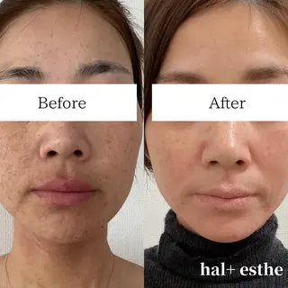 トータルビューティーサロンハルプラス所属・美肌・リラク ハルプラスのエステ・リラクイメージ