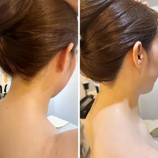 うなじ脱毛/美肌脱毛 LABELのエステ・リラクイメージ