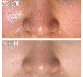 リジュベ所属・Rejuve ﾘｼﾞｭﾍﾞのエステ・リラクイメージ