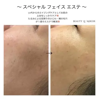 ビューティー ミロワールのエステ・リラクイメージ