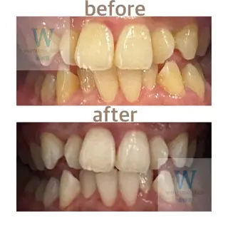 ホワイトニング ショップ船橋２号店のエステ・リラクイメージ