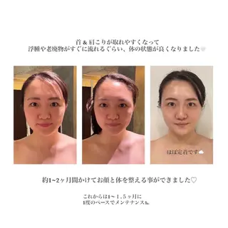 BACI STYLE所属・寧♡ 美肌小顔・ボディケアのエステ・リラクイメージ