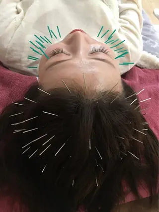 美容鍼灸女性専用 りんご鍼灸治療院のエステ・リラクイメージ