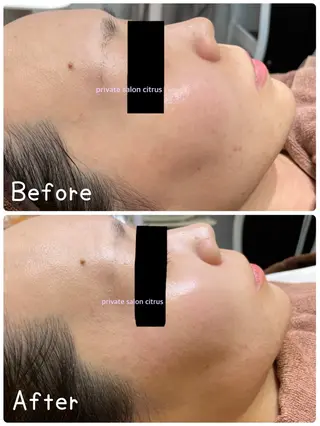 プライベートサロン Citrusのエステ・リラクイメージ