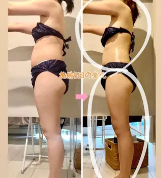 ショート カラー パーマ ヘアアレンジ メンズ キッズ ネイル マツエク・マツパ ‍痩身＆ボディ 結果出し🌟丹野のエステ・リラクイメージ