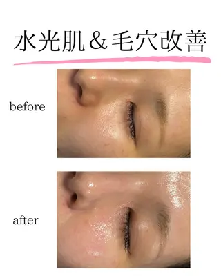 Salon【yuzu.】所属・🍊肌管理×美眉 【yuzu.】の眉毛・アイブロウイメージ