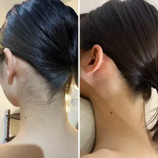 うなじ脱毛/美肌脱毛 LABELのエステ・リラクイメージ