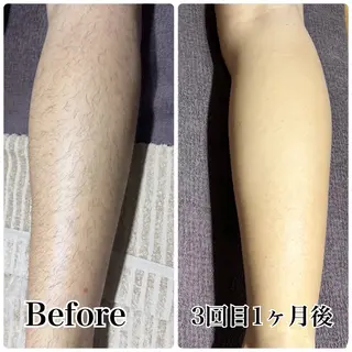 メンズ 片田 ゆいのエステ・リラクイメージ