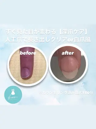 メンズ ネイル 爪ケア/深爪 自爪育成 🐰えむのネイルデザイン