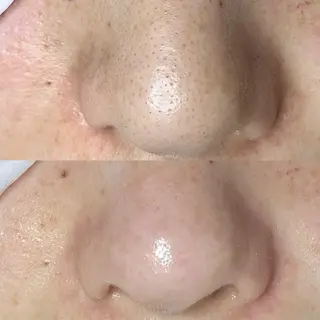 アイラッシュサロン CoCoのマツエク・マツパデザイン