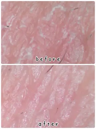 メンズ キッズ 韓国最先端技術サロン Luangeのエステ・リラクイメージ