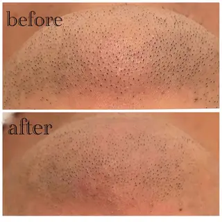 メンズ メンズ脱毛サロン　SHINKA所属・メンズ脱毛サロン SHINKAのエステ・リラクイメージ