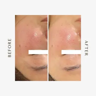 1st｜フェイシャル エステ専門店のエステ・リラクイメージ